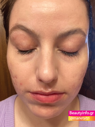 Πως φαίνονται οι βλεφαρίδες