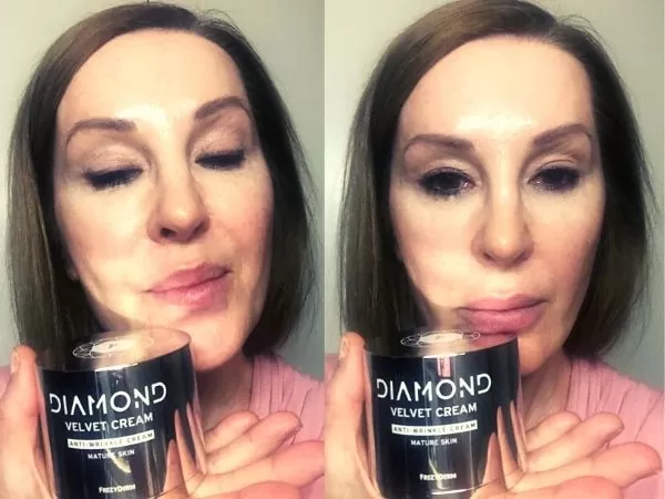 Frezyderm diamond κριτικεσ